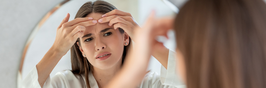 8 Common Acne Causes: How Pimple Patches Help